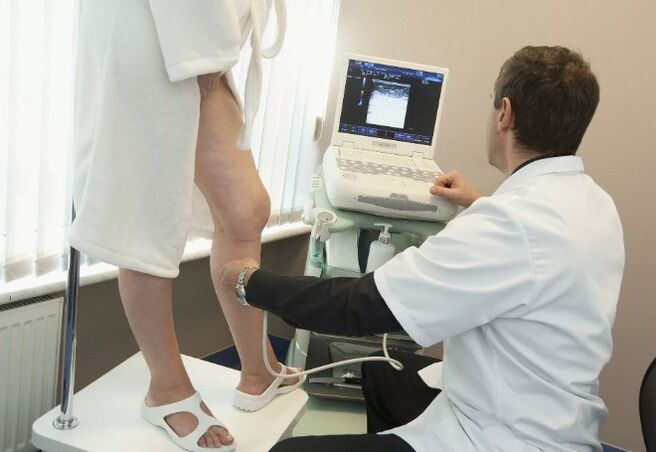 Diagnosis of varicoosa